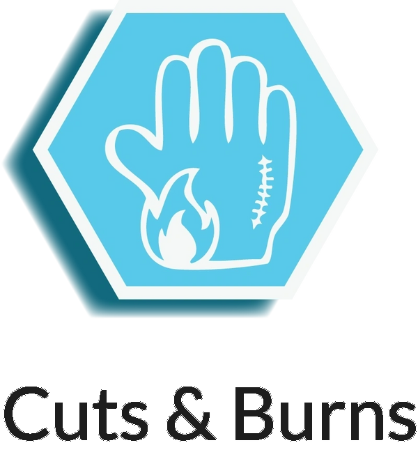 Cut & Burns